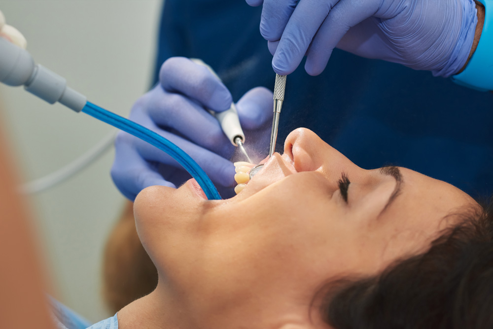 dental cleaning