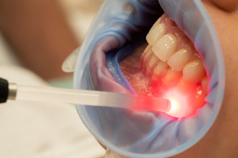 dental therapy with red LED light in the dental office